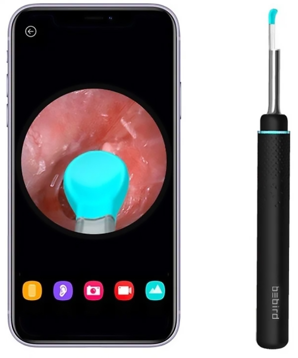 Купить Xiaomi Bebird Ear Wax Removal System M9 Pro Black