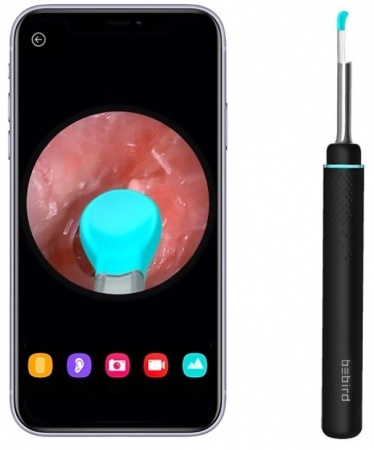Купить Xiaomi Bebird Ear Wax Removal System M9 Pro Black